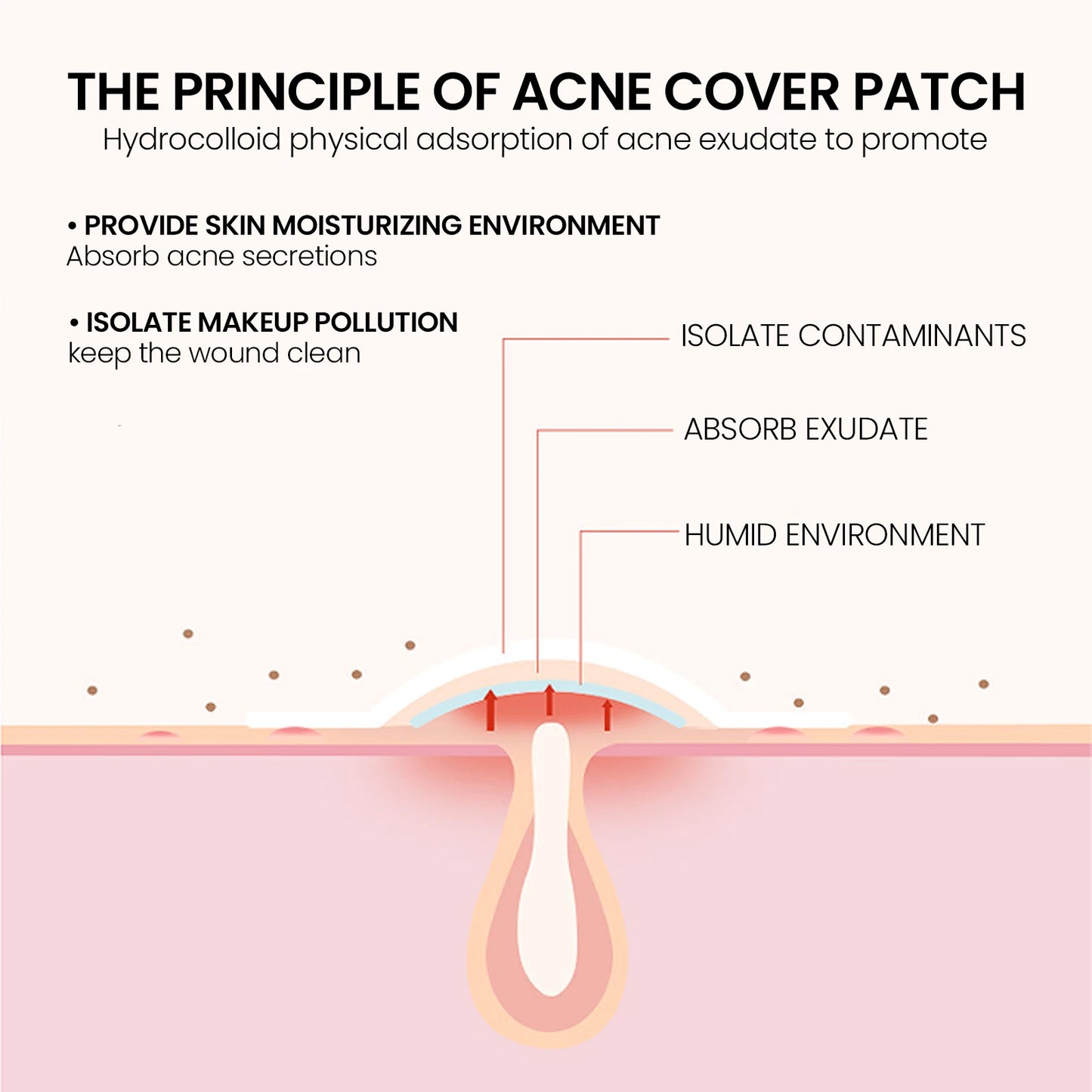 Acne Pimple Patches – Waterproof, Gentle & Non-Irritating Spot Treatment
