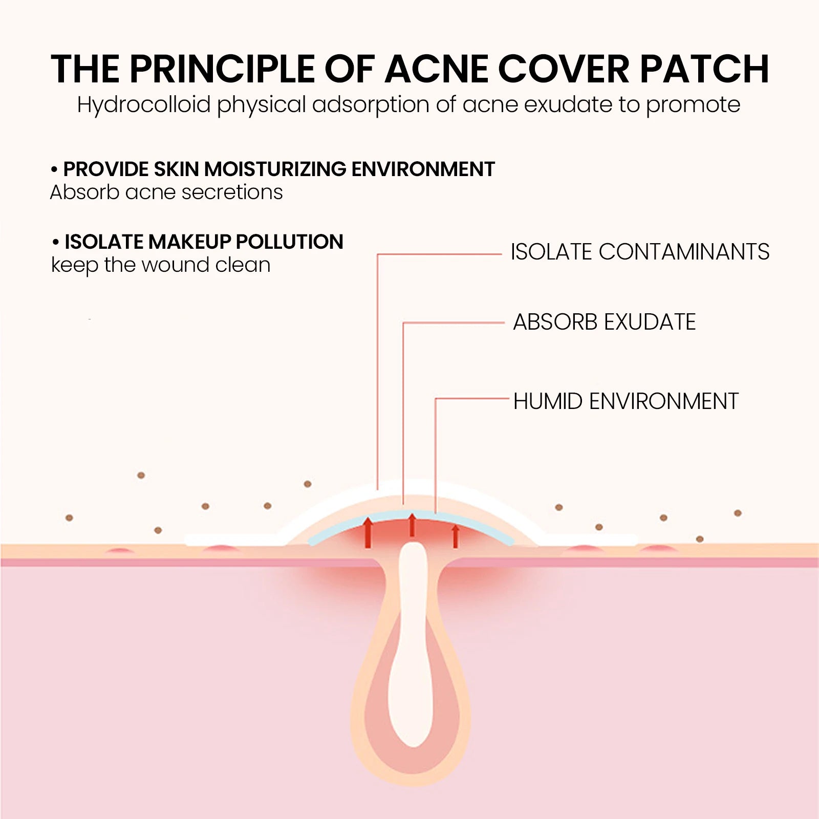 Acne Pimple Patches – Waterproof, Gentle & Non-Irritating Spot Treatment