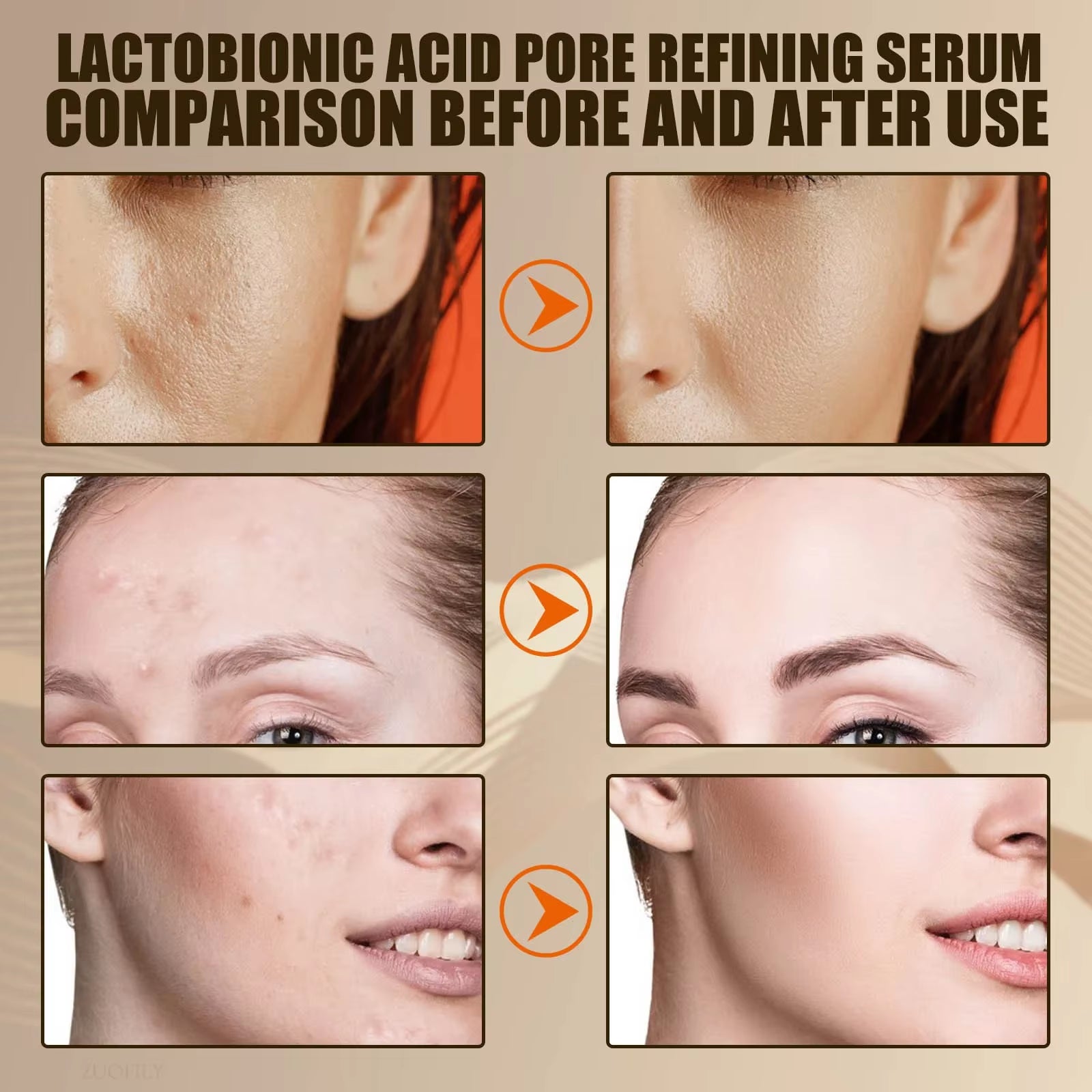 Lactobionic Acid Pore-Refining Serum – Soothing & Balancing Essence